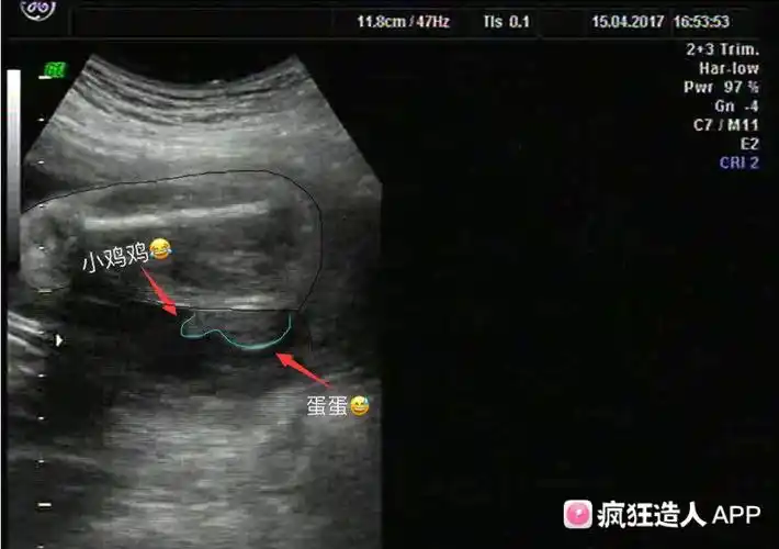 翻看昨天录的四维视频,被我看到了小鸡鸡