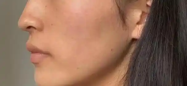 别一味追求大牌了!国货新出"美白淡斑"黑科技,拯救肤色暗沉