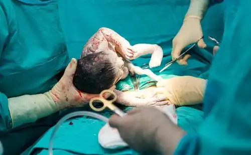 来一起看看婴儿出生的那一刻吧