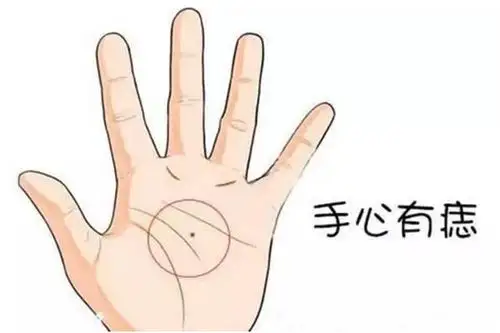 如果遇到一个人在手掌上同样的位置也有痣,那么则是前世的因缘在今世