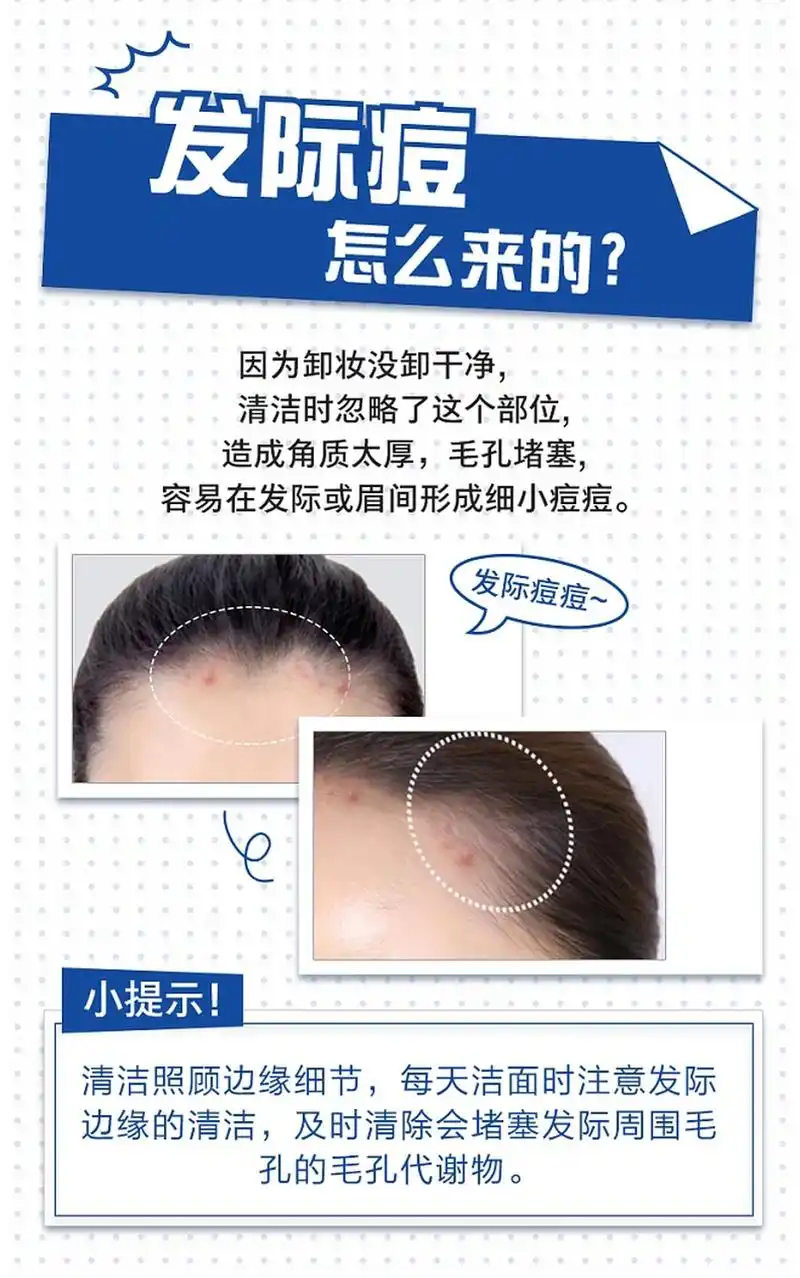 南宁肤康医院是国有的吗 南宁肤康医院是公立的吗 南宁肤康医院收费