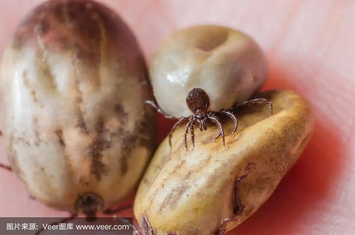 人皮肤上长满血的蜱虫