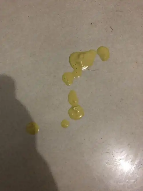 拉了一次.下面是图片.还有没有救