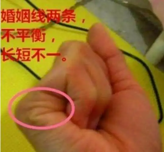通常两条婚姻线,长短不齐,婚前有刻骨铭心的爱情,缺少缘分,没有修成