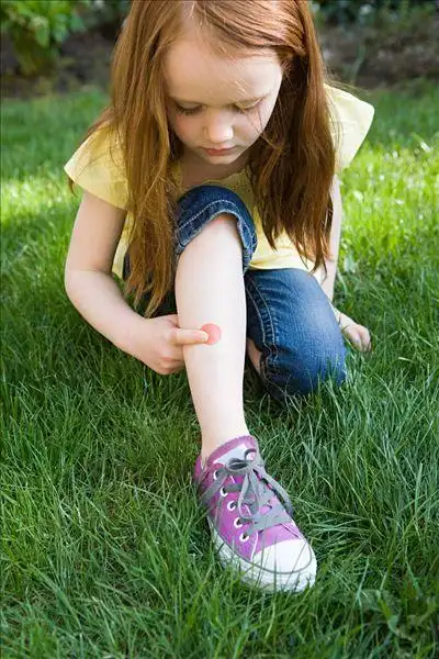 女孩,橡皮膏,腿