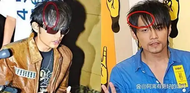 别说黄晓明有秃头烦恼了,就连腰缠万贯的天王周杰伦也难逃脱发的困扰