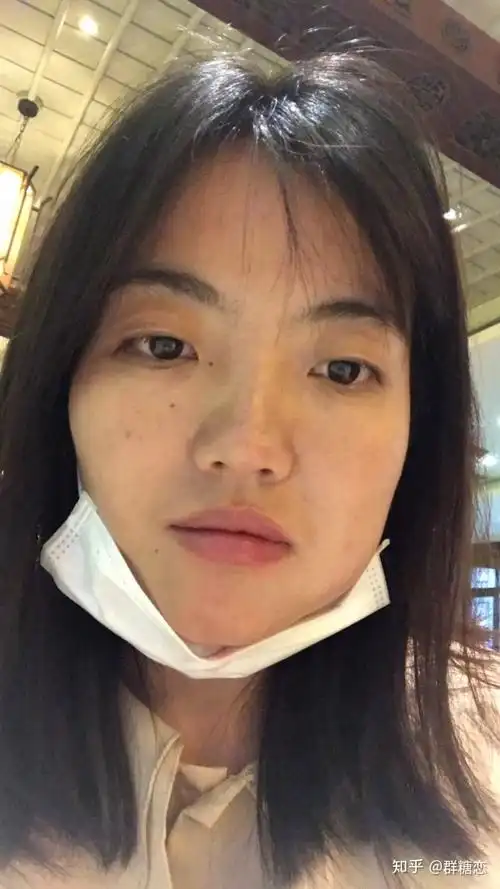 我的虎牙矫正日记