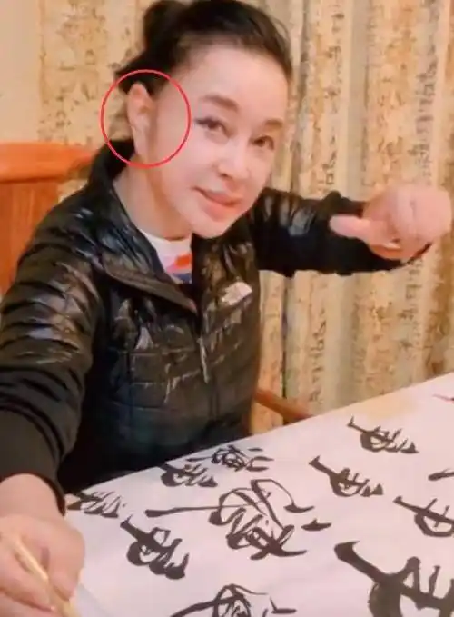 据说,刘晓庆耳朵"变形"是因为她之前做过拉皮整形手术,才造成现在的