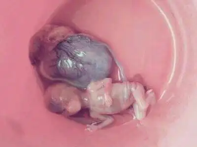 堕胎就是残忍杀害自己的骨肉,这个事实是不会改变的,劝诫每一位