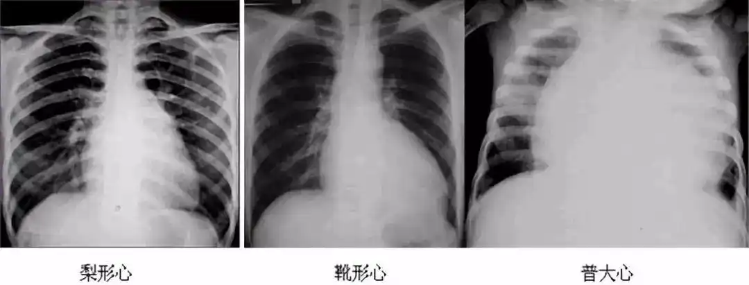 2019年医师实践技能考试x线检查