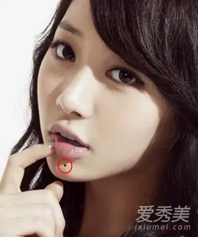 (三)耳垂有痣:意味着这样的人很有福气,生命力旺盛,不容易被病击垮