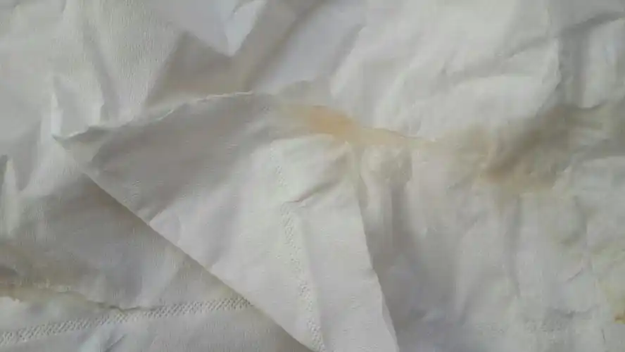 白带夹点点血,有图慎进只看楼主