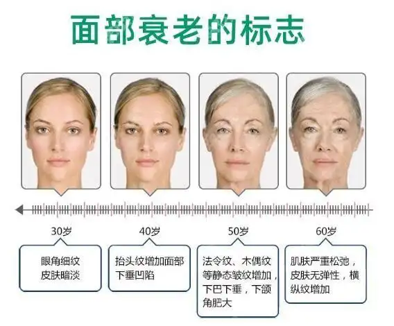 上海伊莱美面部衰老提升适宜人群
