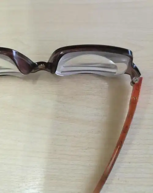 超高度近视,大家见过多少度的?3000度的见过没有?_网易订阅