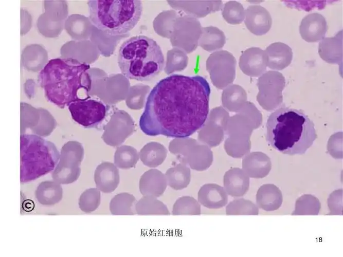 第18页 (共20页,当前第18页) 你可能喜欢 细胞图谱 血细胞形态学 血液