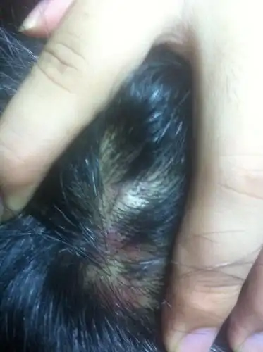 头皮红色肿了 轻按都能感觉疼 怎么治?要是有用追加悬赏