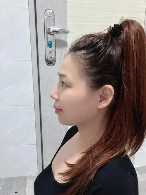 下巴有了侧脸真的是绝绝子