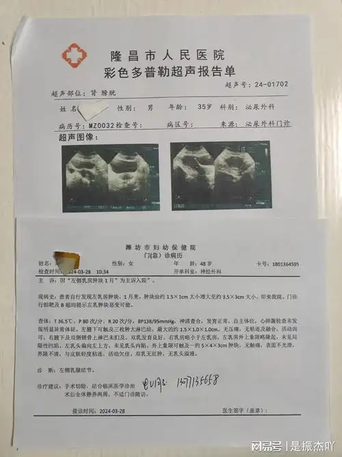 开急性肠胃炎住院证明图片急性肠胃炎入院记录怀孕血检唐山宫外孕开