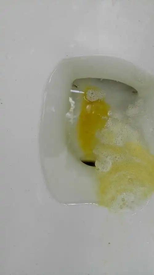 [准备怀孕]大早上吐出来这个,是黄色的但是不苦也不酸