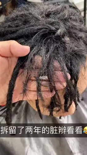 拆脏辫教程记得收藏