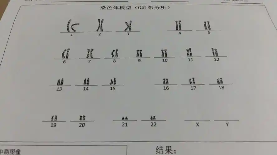 羊水穿刺结果是这样,有懂看的宝妈吗?