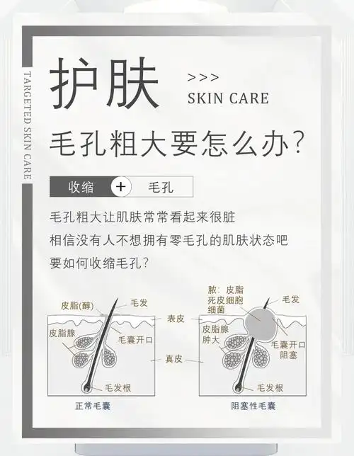 毛孔粗大?4招教你轻松收缩毛孔!