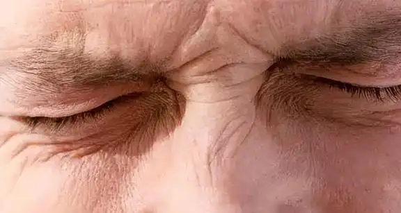 鼻梁出现褶皱主要是指两眼之间,鼻梁之上出现一道横纹,逐渐加深变成一