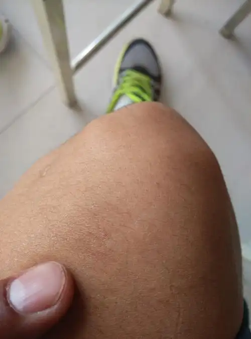 体育生,最近训练力度大,膝盖弯曲会疼,休息了两个星期好了一点,这几天