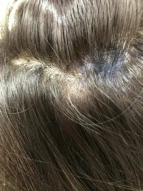 不仅颜色不对 头皮还全毁 我该怎么办