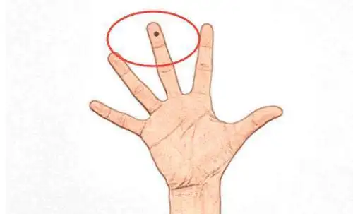 无论男女,三个地方长桃花痣的人最花心,容易二婚