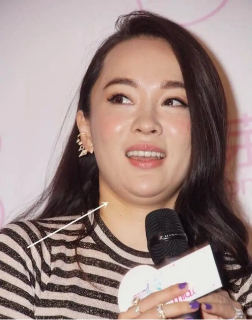 回顾怀孕后发福的女明星有人飙升55斤有人直逼190胖若两人