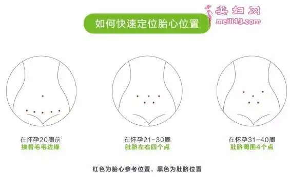 胎心监护仪怎么找胎心