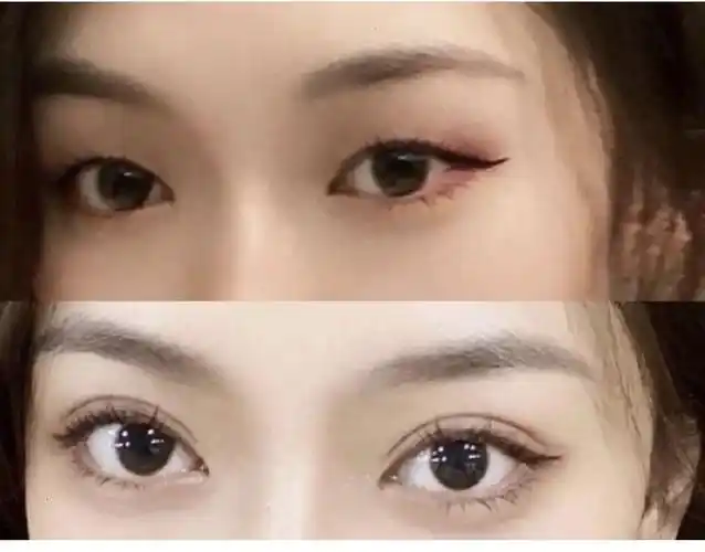 什么型双眼皮好看图片