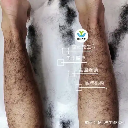 男人能从腿毛判断腹毛吗? - 知乎