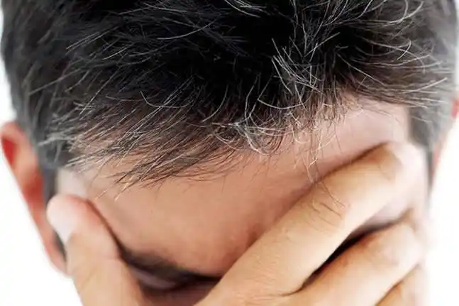 古芳栢草年轻人长白发是什么原因