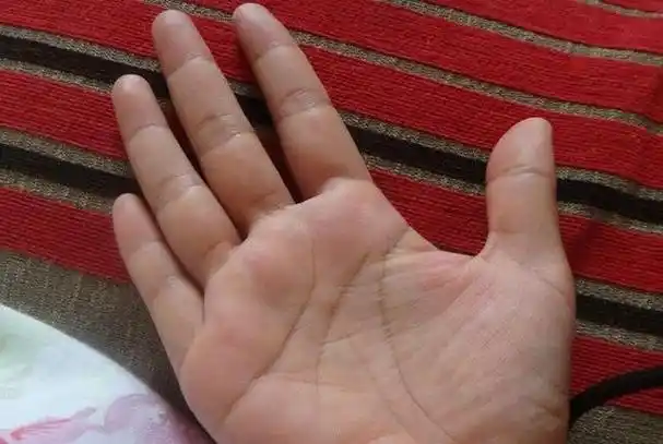 女人富贵命罕见手相小指短 - 冷求网