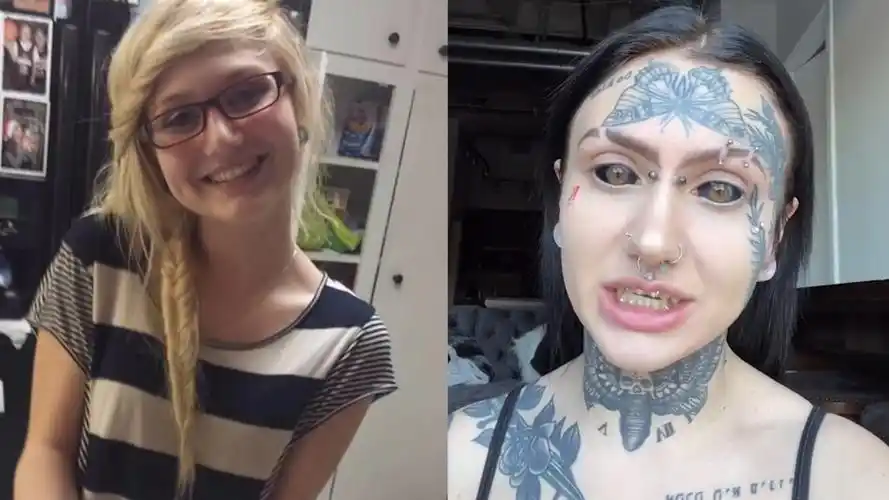 22岁女子眼球上刺青植满口尖牙称"我是怪物",曾长得像爱莎公主_哔哩