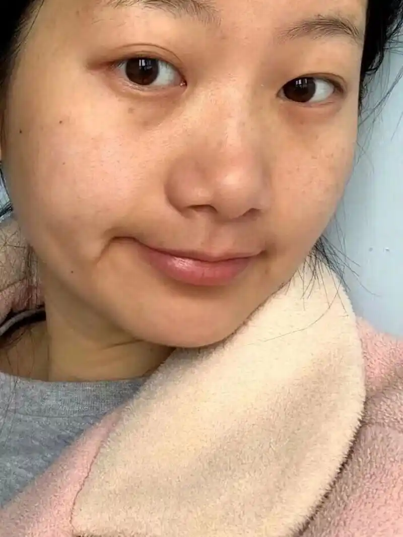 t区,嘴周围蜡黄肤色不均怎么破解啊!