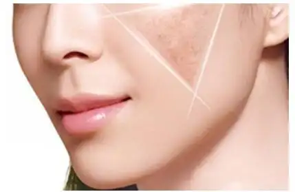 面部皮肤出现这3个现象说明你要变白了