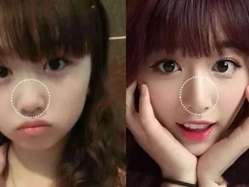 青春有你2里哪些选手是纯天然的孔雪儿做过整形吗