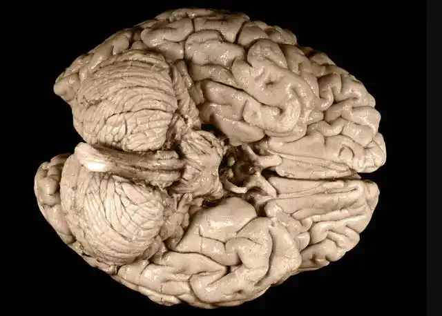 爱因斯坦的狂热粉丝爱他就带他的大脑切片环游世界