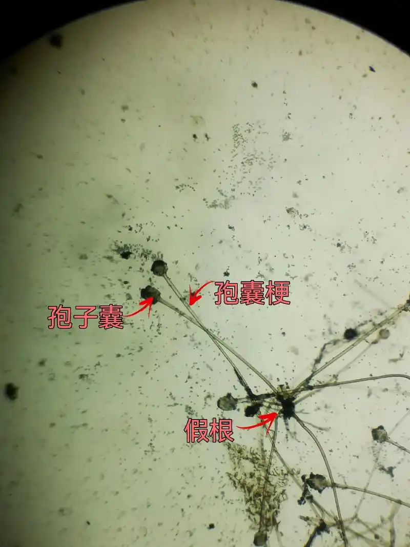 显微镜下的霉菌根霉水果上长出的黑色毛毛