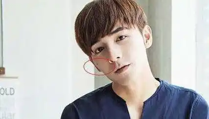 左侧颧骨长痦子好不好,颧骨痣如何看吉和恶