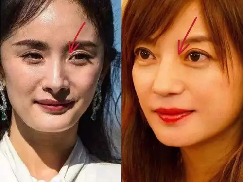 一直被嘲肌无力的刘诗诗,现在竟比杨幂的狐狸眼还灵?