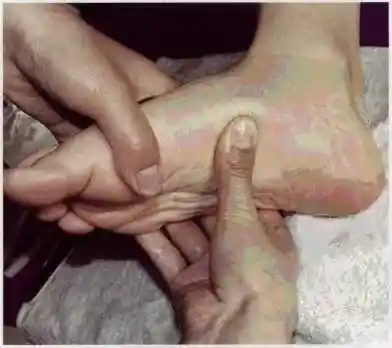 图5-23揉捏踝关节内侧,将顾客足部侧放, 踝关节内侧向上并进行按摩