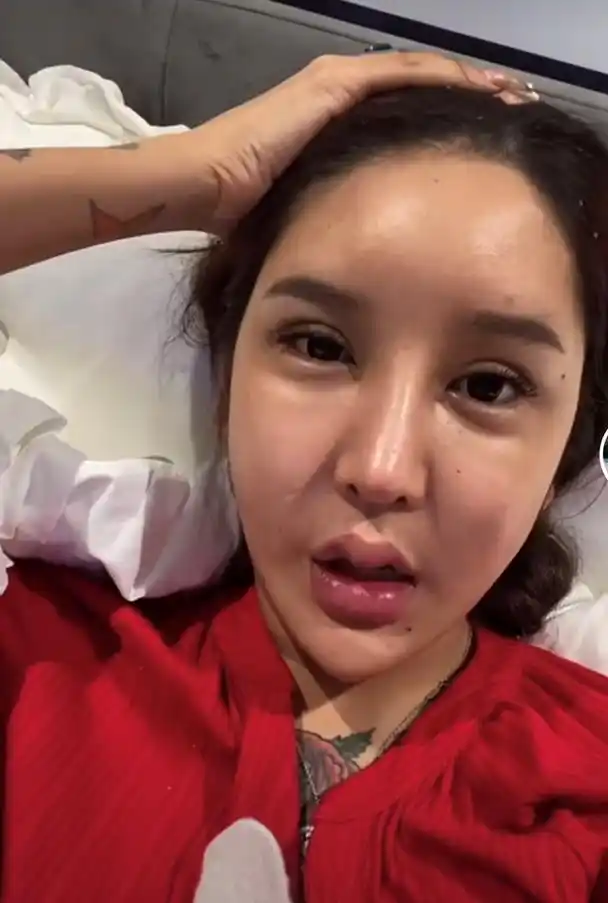 网红自曝整容后遗症,假体歪斜眼睛抽搐,却仍然不愿停下