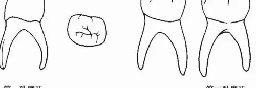 【图】牙体解剖:前牙,前磨牙,磨牙