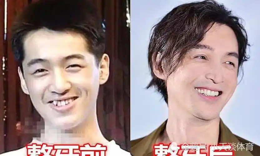 原创盘点明星整牙前vs后胡歌高圆圆杨幂颜值逆袭看到她你咋这么优秀