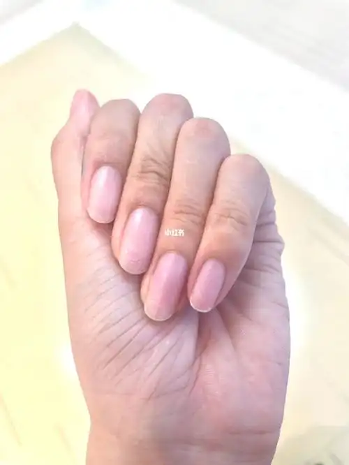 甲床太长了好丑