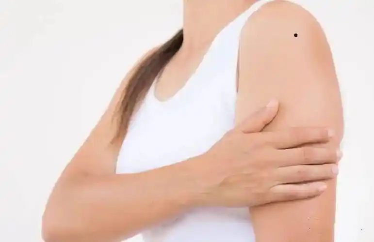 手臂上的痣有何含义_性格_生活_右臂